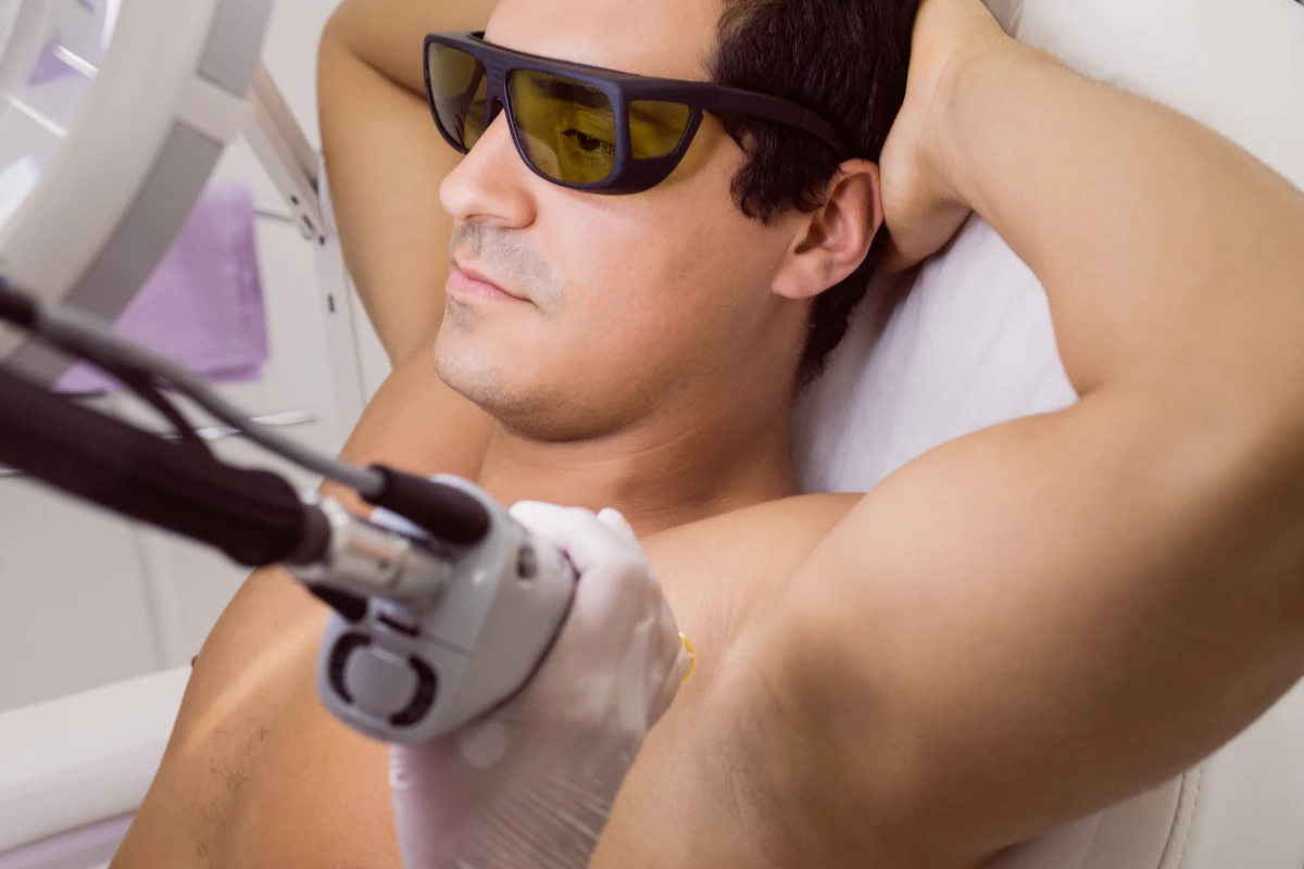 depila_o_a_laser_masculina